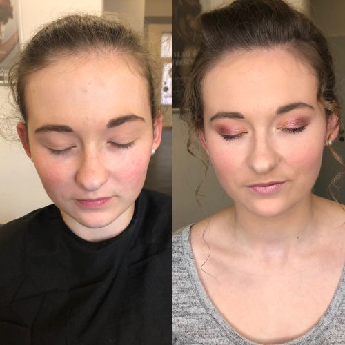 image1 image1